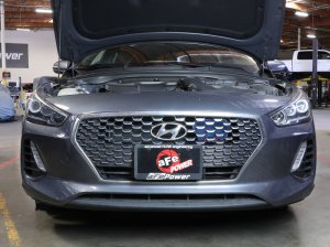 Hyundai Elantra GT Performance Air Intake - aFe - Dynamic Air Scoop (D.A.S.) - Blue - `18-`20 Hyundai Elantra GT Performance Air Intake - aFe - Dynamic Air Scoop (D.A.S.) - Blue - `18-`20