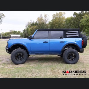 Ford Bronco Fender Flare Delete Kit - 4 Door - Rough Country