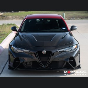 Alfa Romeo Giulia GTAm Style Front Fenders - Carbon Fiber